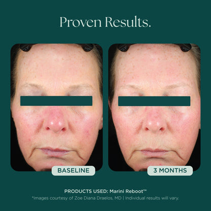 Marini SkinSolutions - Marini Reboot® PDRN Face Serum (1 oz)