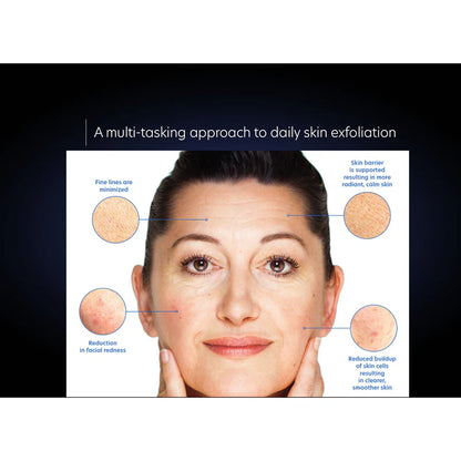 PCA SKIN - Resurfacing Serum (1 oz - 29 ml) - Available in Deluxe Travel Size