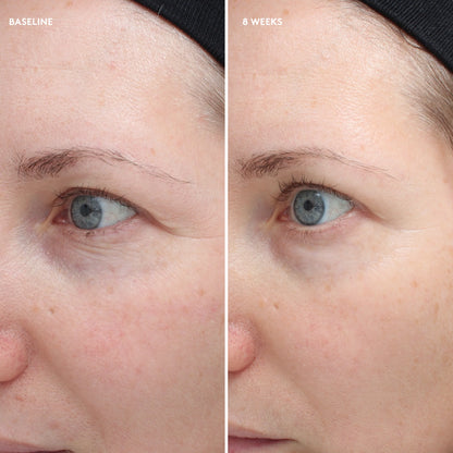 COLORESCIENCE - Total Eye® Firm & Repair Cream (0.6 oz)