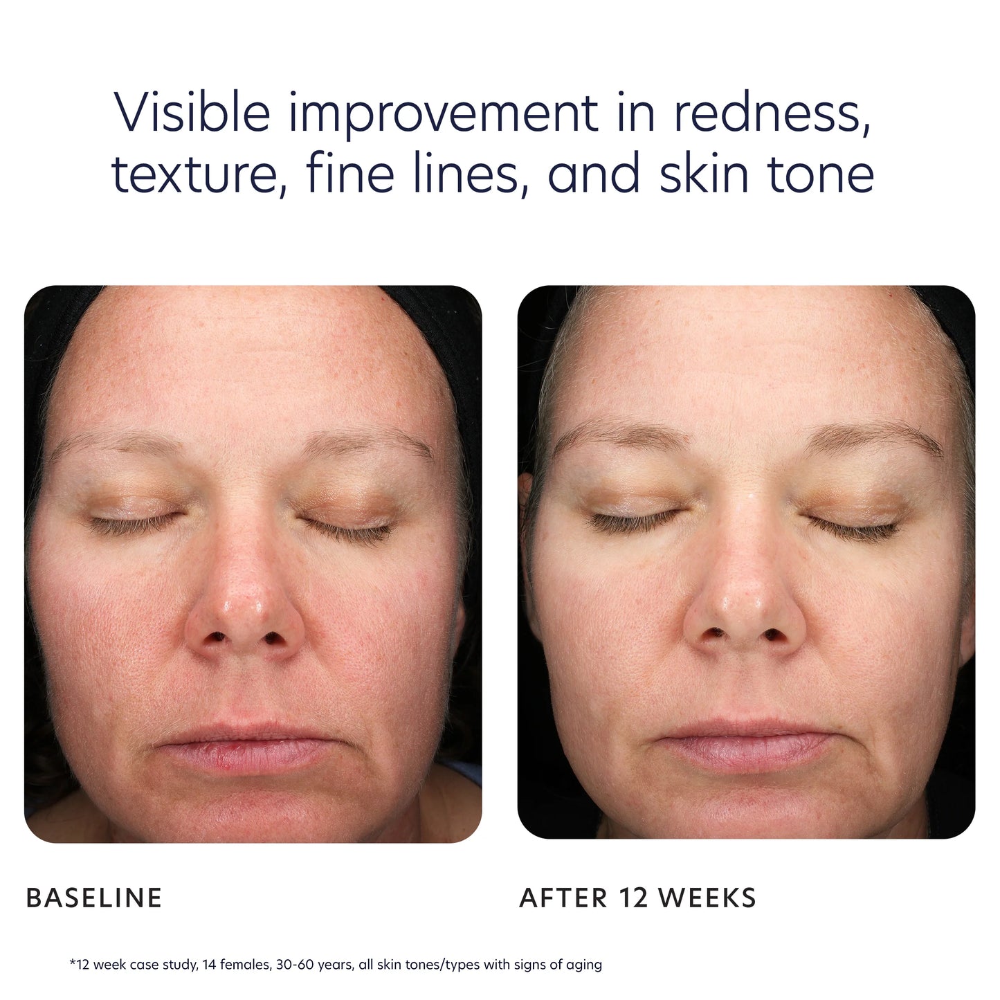 PCA SKIN - Triple Exfoliation Peel Pads (30 pads)