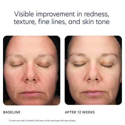 PCA SKIN - Triple Exfoliation Peel Pads (30 pads)