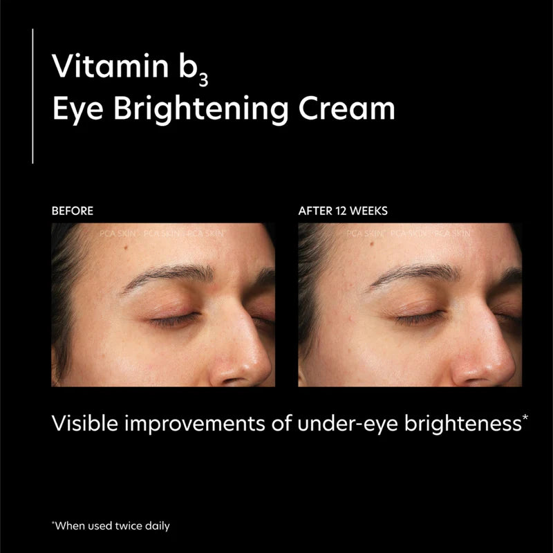 PCA SKIN - Vitamin b3 Eye Brightening Cream (0.46 oz)